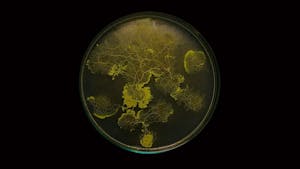 CI et GAD // Réseaux-mondes